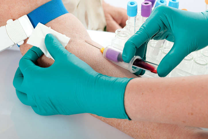 Covid-19 Antibody test